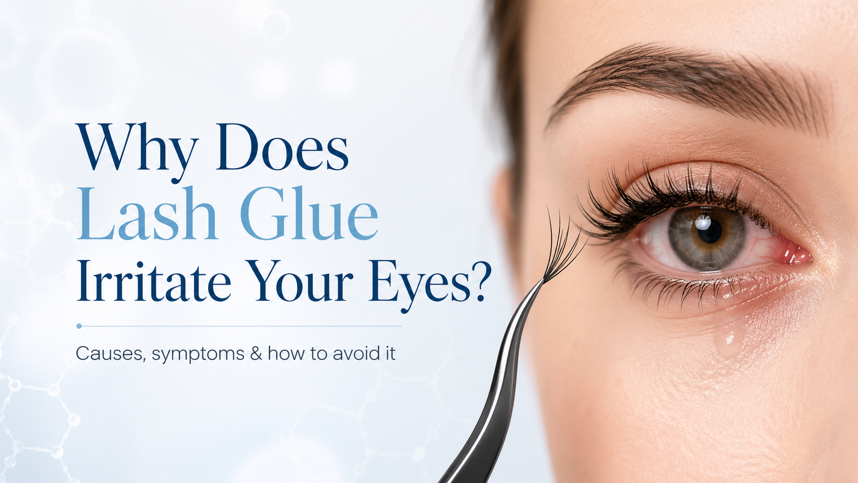 Why Does Lash Glue Irritate Your Eyes? Causes, Symptoms & How to Avoid It